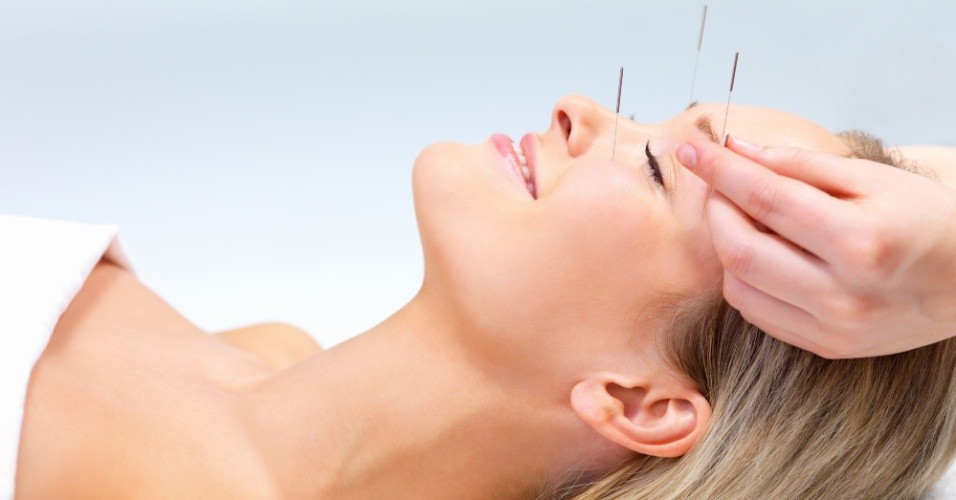 acupuntura facial: Conheça todas as vantagens
