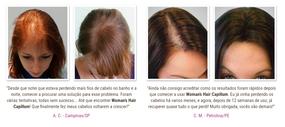 womans hair capillum